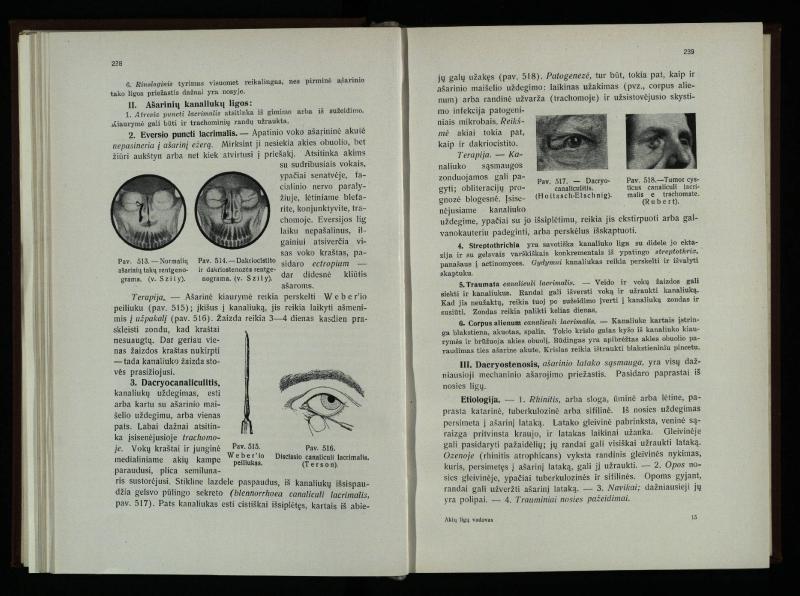 Akių ligų vadovas / Petras Avižonis. – Kaunas: Medicinos fakultetao leidinys, 1940. – VIII, 841, [2] p., 18 iliustr. lap.