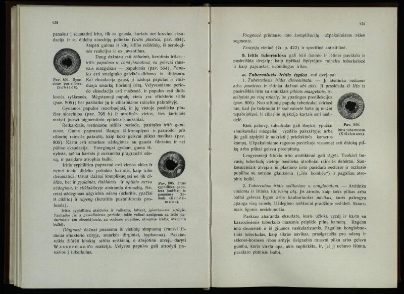 Akių ligų vadovas / Petras Avižonis. – Kaunas: Medicinos fakultetao leidinys, 1940. – VIII, 841, [2] p., 18 iliustr. lap.