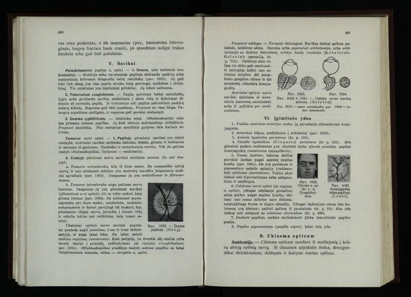 Akių ligų vadovas / Petras Avižonis. – Kaunas: Medicinos fakultetao leidinys, 1940. – VIII, 841, [2] p., 18 iliustr. lap.