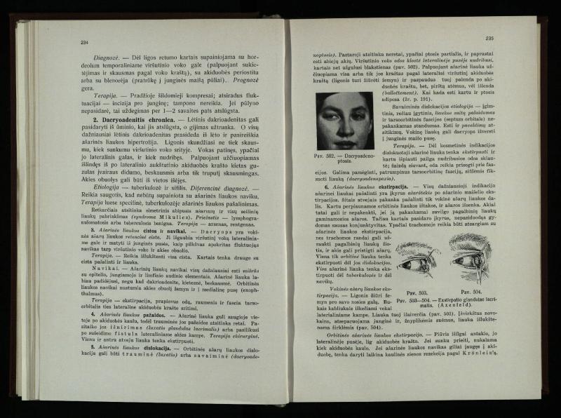 Akių ligų vadovas / Petras Avižonis. – Kaunas: Medicinos fakultetao leidinys, 1940. – VIII, 841, [2] p., 18 iliustr. lap.