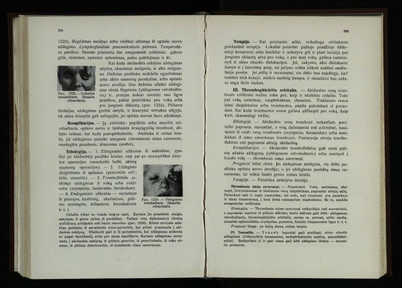 Akių ligų vadovas / Petras Avižonis. – Kaunas: Medicinos fakultetao leidinys, 1940. – VIII, 841, [2] p., 18 iliustr. lap.