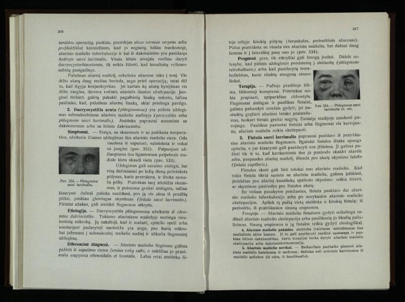 Akių ligų vadovas / Petras Avižonis. – Kaunas: Medicinos fakultetao leidinys, 1940. – VIII, 841, [2] p., 18 iliustr. lap.