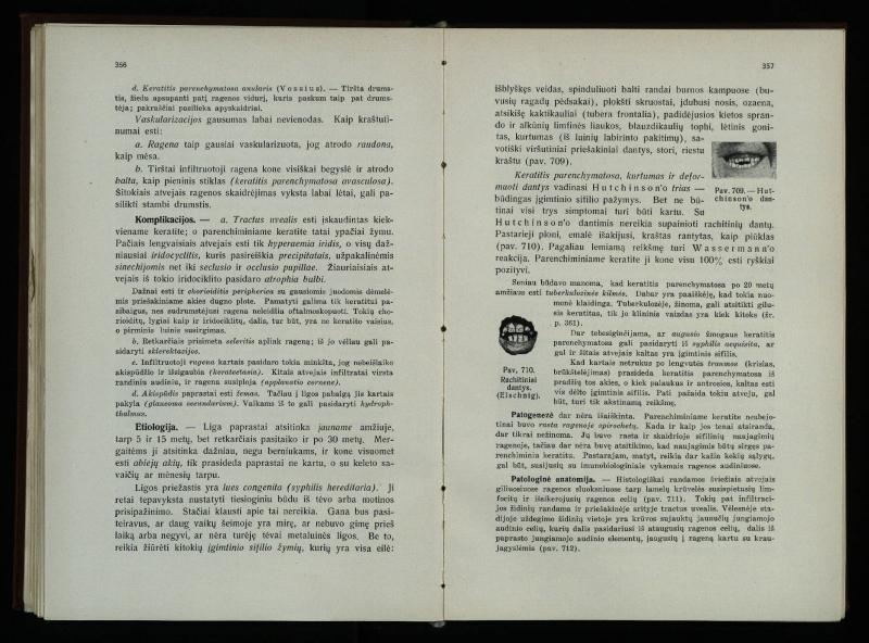 Akių ligų vadovas / Petras Avižonis. – Kaunas: Medicinos fakultetao leidinys, 1940. – VIII, 841, [2] p., 18 iliustr. lap.