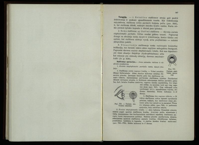 Akių ligų vadovas / Petras Avižonis. – Kaunas: Medicinos fakultetao leidinys, 1940. – VIII, 841, [2] p., 18 iliustr. lap.