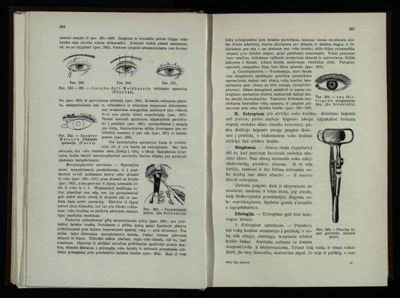 Akių ligų vadovas / Petras Avižonis. – Kaunas: Medicinos fakultetao leidinys, 1940. – VIII, 841, [2] p., 18 iliustr. lap.