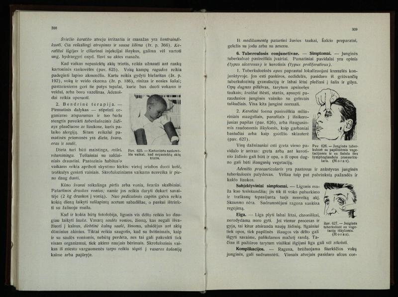 Akių ligų vadovas / Petras Avižonis. – Kaunas: Medicinos fakultetao leidinys, 1940. – VIII, 841, [2] p., 18 iliustr. lap.