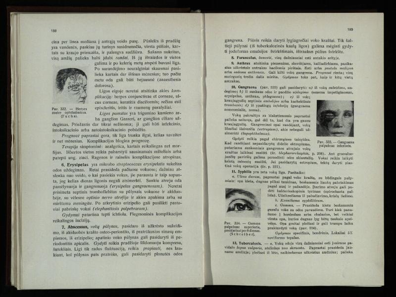 Akių ligų vadovas / Petras Avižonis. – Kaunas: Medicinos fakultetao leidinys, 1940. – VIII, 841, [2] p., 18 iliustr. lap.