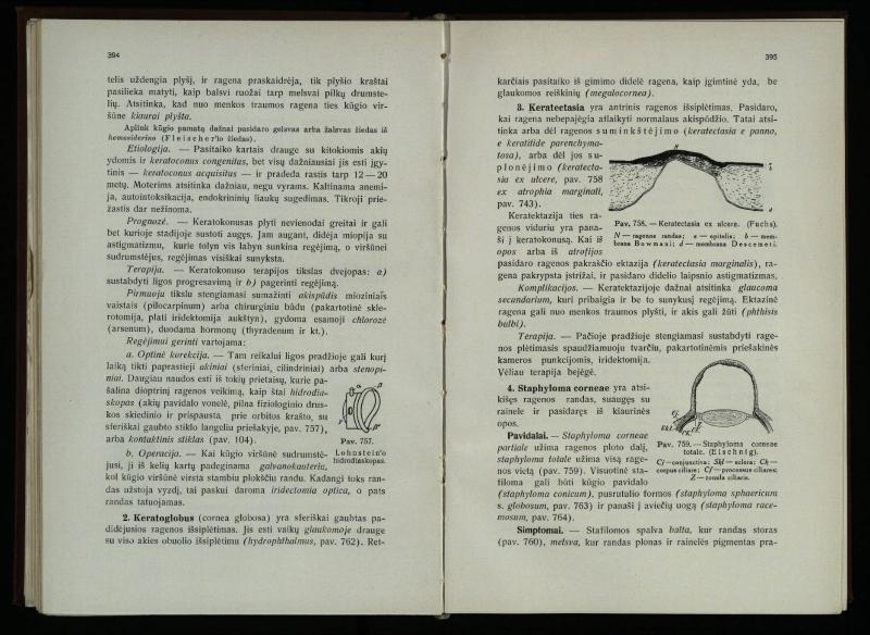 Akių ligų vadovas / Petras Avižonis. – Kaunas: Medicinos fakultetao leidinys, 1940. – VIII, 841, [2] p., 18 iliustr. lap.