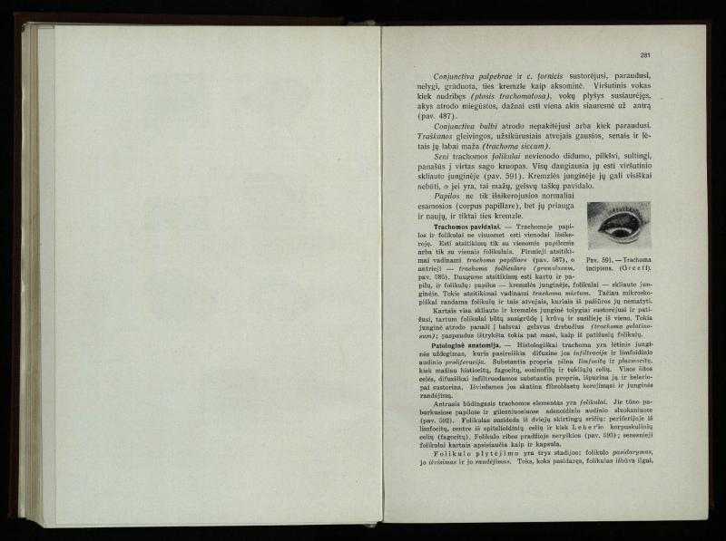 Akių ligų vadovas / Petras Avižonis. – Kaunas: Medicinos fakultetao leidinys, 1940. – VIII, 841, [2] p., 18 iliustr. lap.