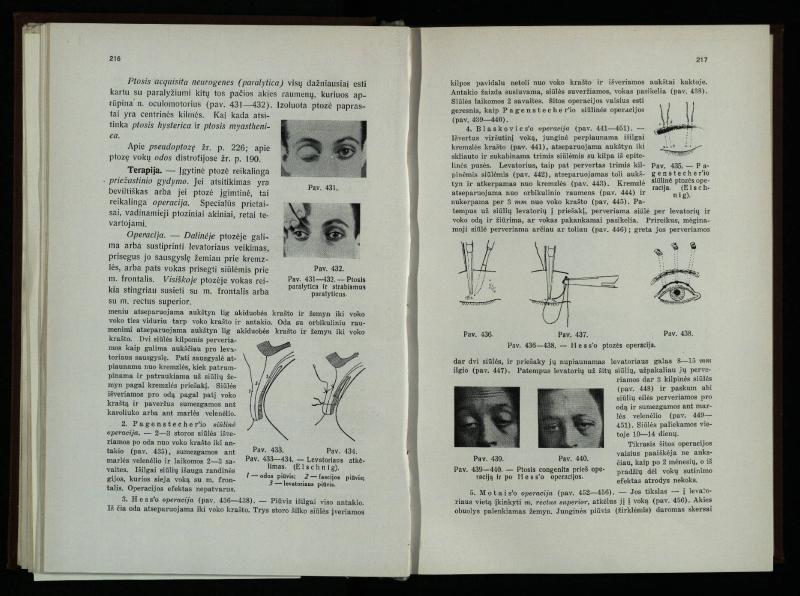 Akių ligų vadovas / Petras Avižonis. – Kaunas: Medicinos fakultetao leidinys, 1940. – VIII, 841, [2] p., 18 iliustr. lap.