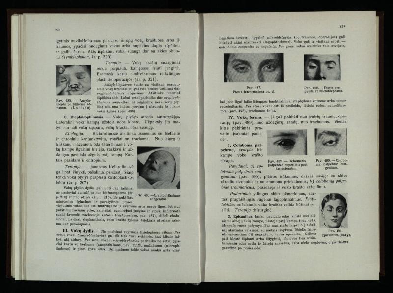 Akių ligų vadovas / Petras Avižonis. – Kaunas: Medicinos fakultetao leidinys, 1940. – VIII, 841, [2] p., 18 iliustr. lap.