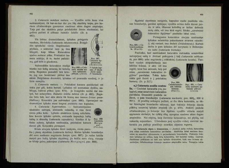 Akių ligų vadovas / Petras Avižonis. – Kaunas: Medicinos fakultetao leidinys, 1940. – VIII, 841, [2] p., 18 iliustr. lap.