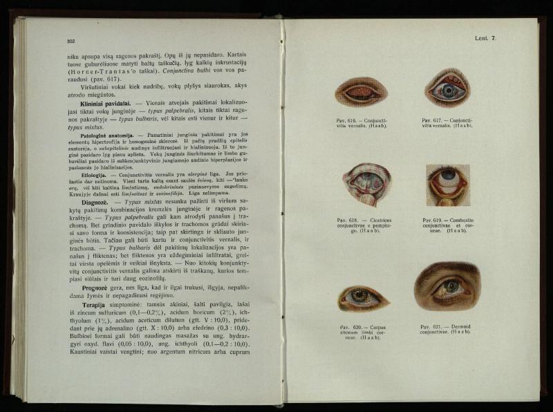 Akių ligų vadovas / Petras Avižonis. – Kaunas: Medicinos fakultetao leidinys, 1940. – VIII, 841, [2] p., 18 iliustr. lap.