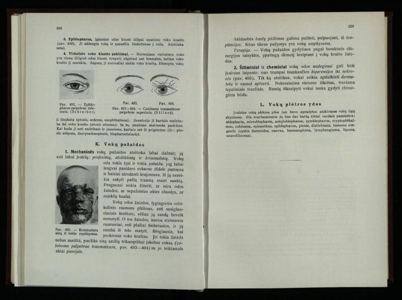 Akių ligų vadovas / Petras Avižonis. – Kaunas: Medicinos fakultetao leidinys, 1940. – VIII, 841, [2] p., 18 iliustr. lap.