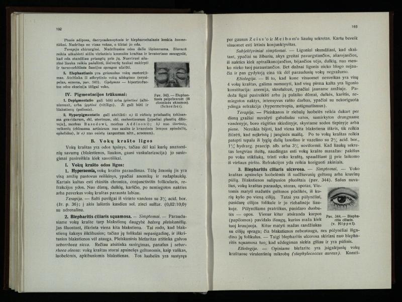 Akių ligų vadovas / Petras Avižonis. – Kaunas: Medicinos fakultetao leidinys, 1940. – VIII, 841, [2] p., 18 iliustr. lap.