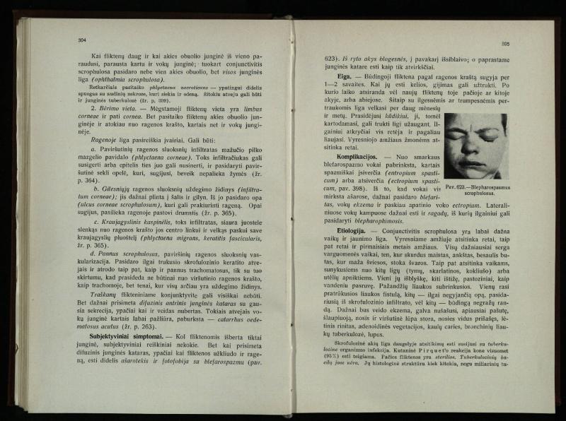 Akių ligų vadovas / Petras Avižonis. – Kaunas: Medicinos fakultetao leidinys, 1940. – VIII, 841, [2] p., 18 iliustr. lap.