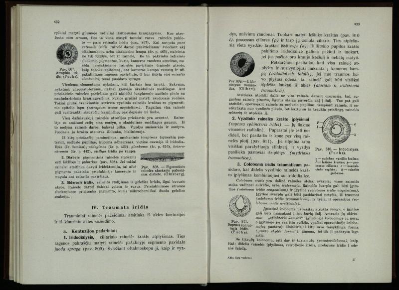 Akių ligų vadovas / Petras Avižonis. – Kaunas: Medicinos fakultetao leidinys, 1940. – VIII, 841, [2] p., 18 iliustr. lap.