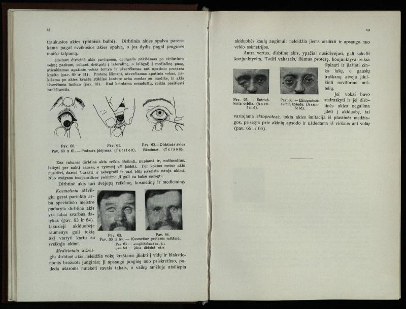 Akių ligų vadovas / Petras Avižonis. – Kaunas: Medicinos fakultetao leidinys, 1940. – VIII, 841, [2] p., 18 iliustr. lap.