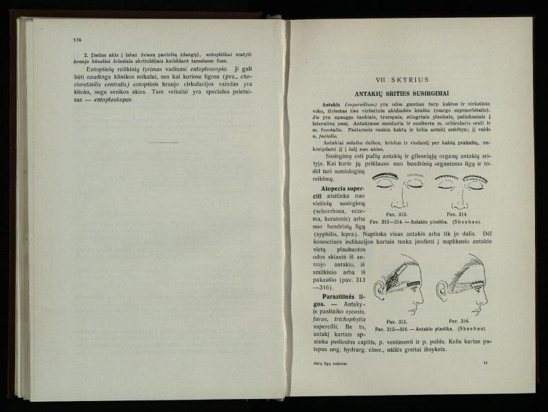 Akių ligų vadovas / Petras Avižonis. – Kaunas: Medicinos fakultetao leidinys, 1940. – VIII, 841, [2] p., 18 iliustr. lap.