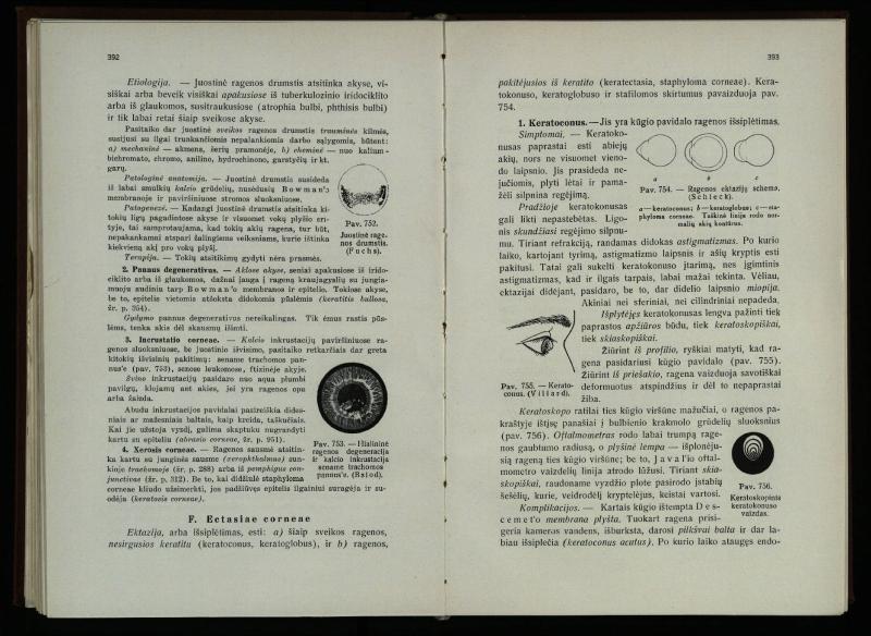 Akių ligų vadovas / Petras Avižonis. – Kaunas: Medicinos fakultetao leidinys, 1940. – VIII, 841, [2] p., 18 iliustr. lap.