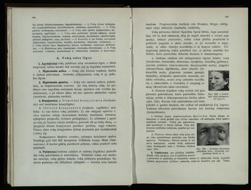Akių ligų vadovas / Petras Avižonis. – Kaunas: Medicinos fakultetao leidinys, 1940. – VIII, 841, [2] p., 18 iliustr. lap.