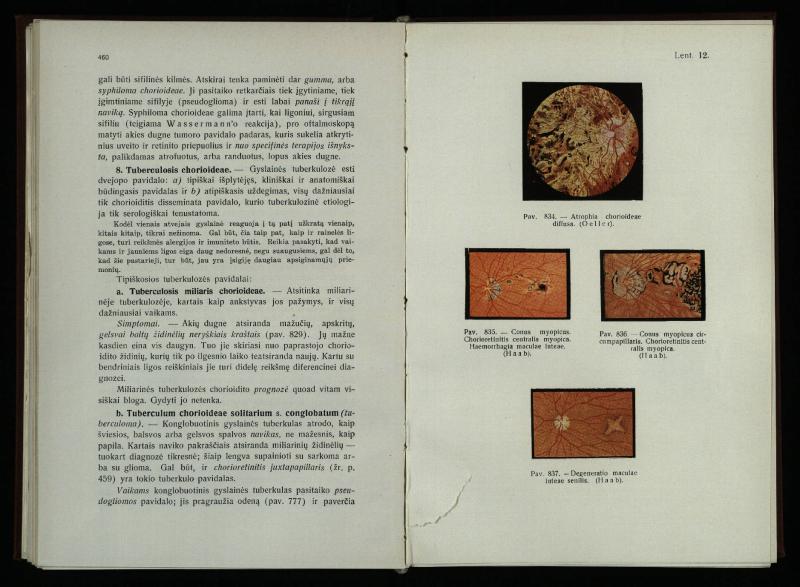 Akių ligų vadovas / Petras Avižonis. – Kaunas: Medicinos fakultetao leidinys, 1940. – VIII, 841, [2] p., 18 iliustr. lap.
