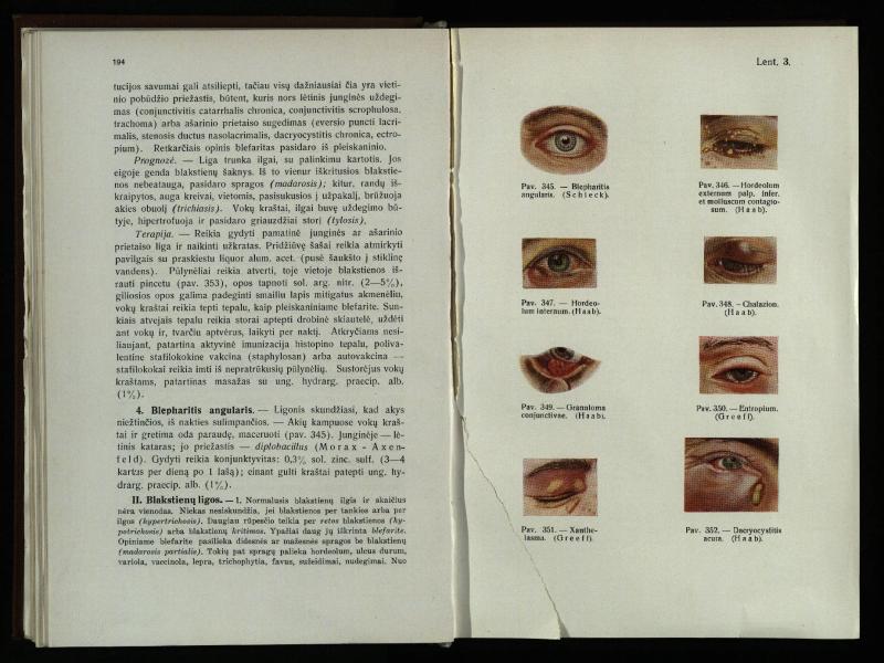 Akių ligų vadovas / Petras Avižonis. – Kaunas: Medicinos fakultetao leidinys, 1940. – VIII, 841, [2] p., 18 iliustr. lap.