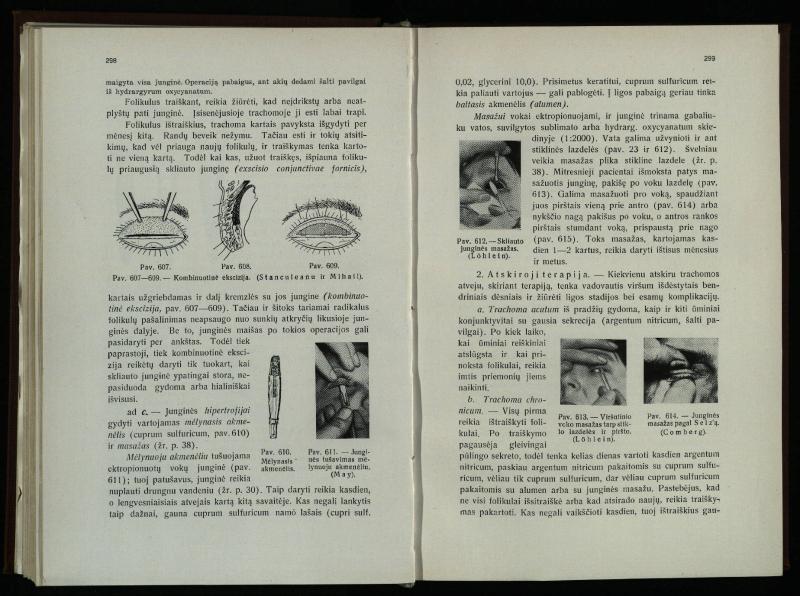 Akių ligų vadovas / Petras Avižonis. – Kaunas: Medicinos fakultetao leidinys, 1940. – VIII, 841, [2] p., 18 iliustr. lap.