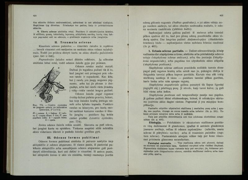Akių ligų vadovas / Petras Avižonis. – Kaunas: Medicinos fakultetao leidinys, 1940. – VIII, 841, [2] p., 18 iliustr. lap.