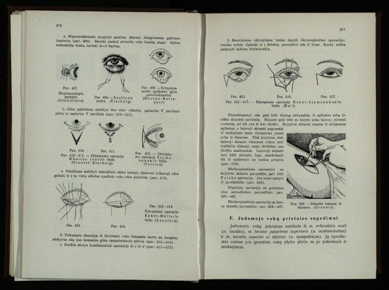 Akių ligų vadovas / Petras Avižonis. – Kaunas: Medicinos fakultetao leidinys, 1940. – VIII, 841, [2] p., 18 iliustr. lap.