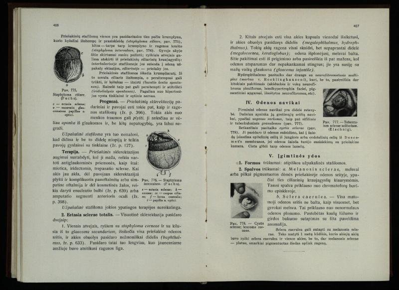 Akių ligų vadovas / Petras Avižonis. – Kaunas: Medicinos fakultetao leidinys, 1940. – VIII, 841, [2] p., 18 iliustr. lap.