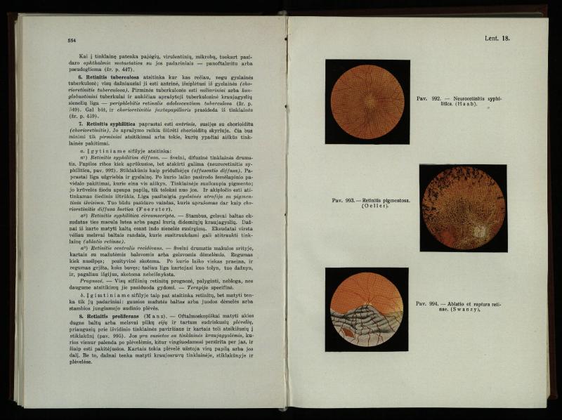 Akių ligų vadovas / Petras Avižonis. – Kaunas: Medicinos fakultetao leidinys, 1940. – VIII, 841, [2] p., 18 iliustr. lap.
