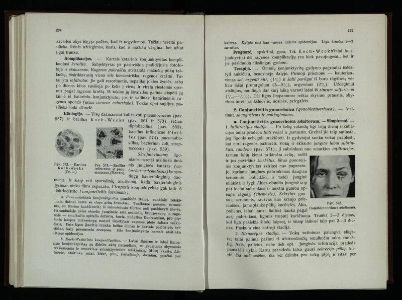 Akių ligų vadovas / Petras Avižonis. – Kaunas: Medicinos fakultetao leidinys, 1940. – VIII, 841, [2] p., 18 iliustr. lap.