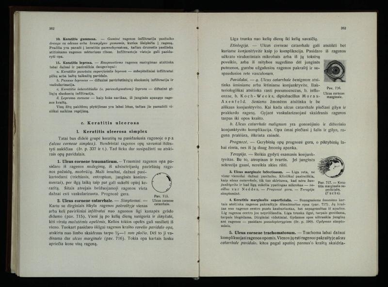 Akių ligų vadovas / Petras Avižonis. – Kaunas: Medicinos fakultetao leidinys, 1940. – VIII, 841, [2] p., 18 iliustr. lap.