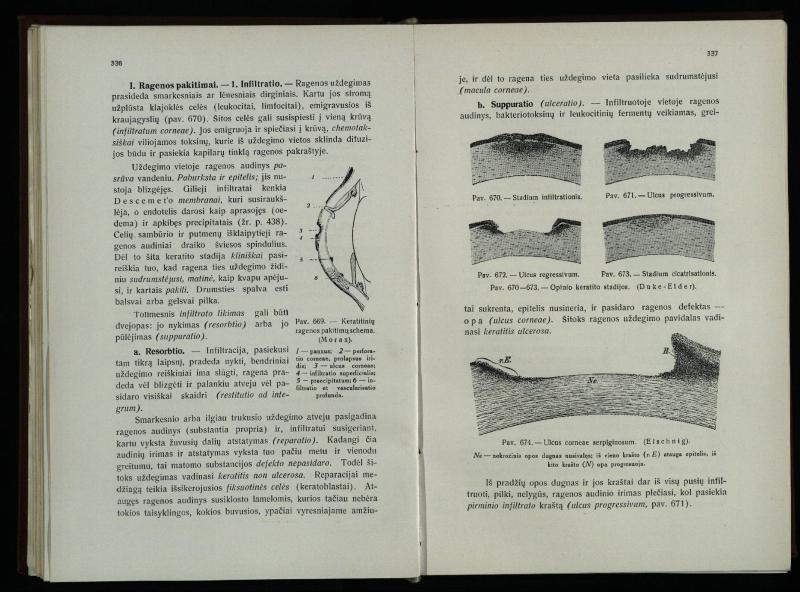 Akių ligų vadovas / Petras Avižonis. – Kaunas: Medicinos fakultetao leidinys, 1940. – VIII, 841, [2] p., 18 iliustr. lap.