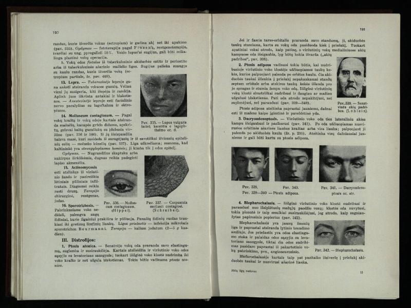 Akių ligų vadovas / Petras Avižonis. – Kaunas: Medicinos fakultetao leidinys, 1940. – VIII, 841, [2] p., 18 iliustr. lap.