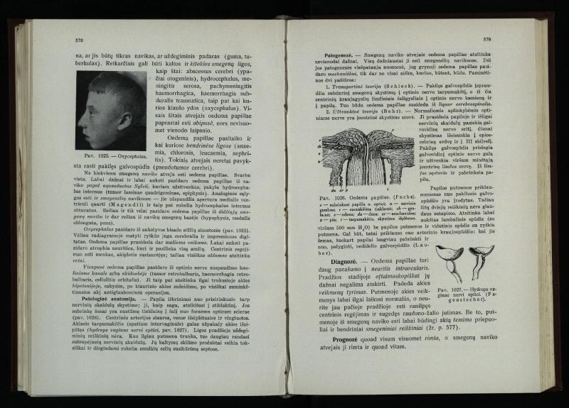 Akių ligų vadovas / Petras Avižonis. – Kaunas: Medicinos fakultetao leidinys, 1940. – VIII, 841, [2] p., 18 iliustr. lap.