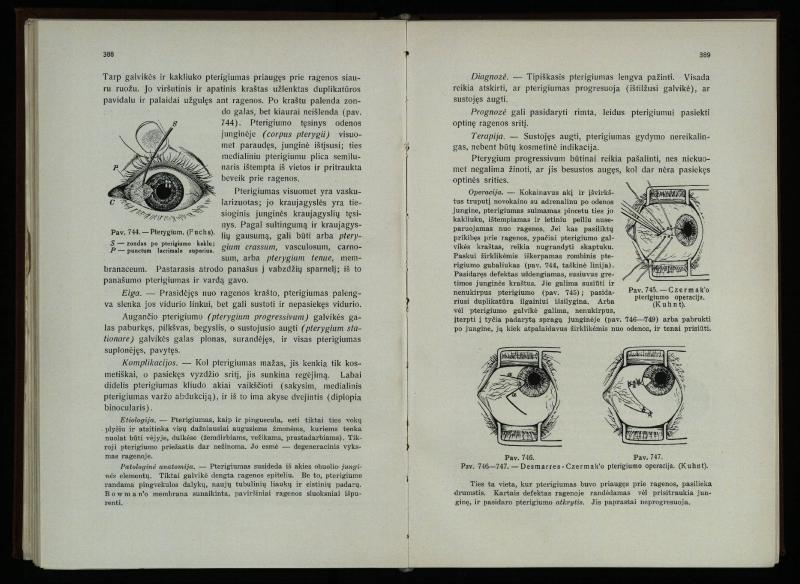 Akių ligų vadovas / Petras Avižonis. – Kaunas: Medicinos fakultetao leidinys, 1940. – VIII, 841, [2] p., 18 iliustr. lap.