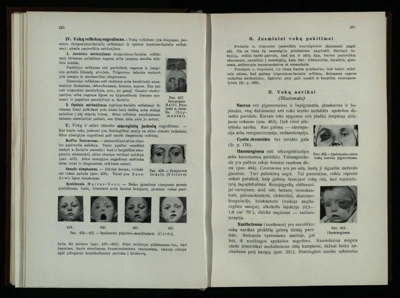 Akių ligų vadovas / Petras Avižonis. – Kaunas: Medicinos fakultetao leidinys, 1940. – VIII, 841, [2] p., 18 iliustr. lap.