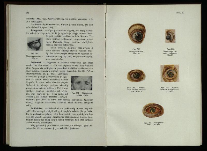 Akių ligų vadovas / Petras Avižonis. – Kaunas: Medicinos fakultetao leidinys, 1940. – VIII, 841, [2] p., 18 iliustr. lap.