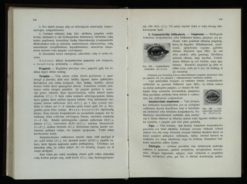 Akių ligų vadovas / Petras Avižonis. – Kaunas: Medicinos fakultetao leidinys, 1940. – VIII, 841, [2] p., 18 iliustr. lap.