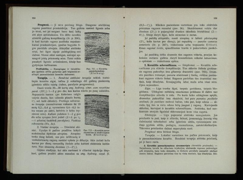 Akių ligų vadovas / Petras Avižonis. – Kaunas: Medicinos fakultetao leidinys, 1940. – VIII, 841, [2] p., 18 iliustr. lap.