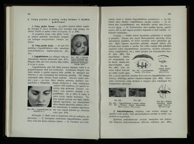 Akių ligų vadovas / Petras Avižonis. – Kaunas: Medicinos fakultetao leidinys, 1940. – VIII, 841, [2] p., 18 iliustr. lap.