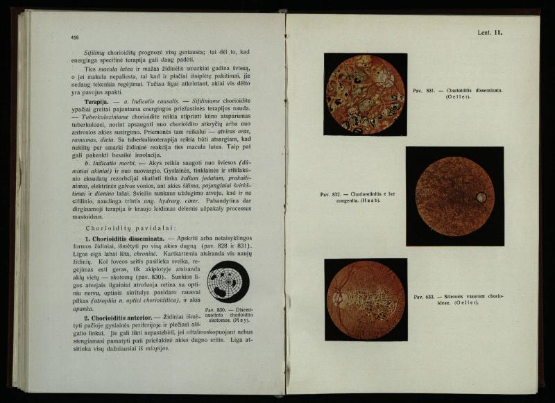 Akių ligų vadovas / Petras Avižonis. – Kaunas: Medicinos fakultetao leidinys, 1940. – VIII, 841, [2] p., 18 iliustr. lap.