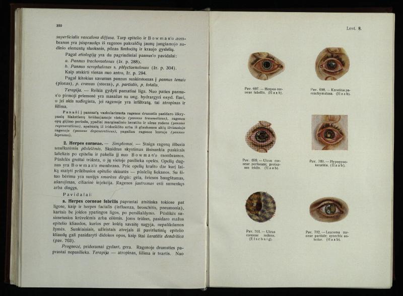 Akių ligų vadovas / Petras Avižonis. – Kaunas: Medicinos fakultetao leidinys, 1940. – VIII, 841, [2] p., 18 iliustr. lap.