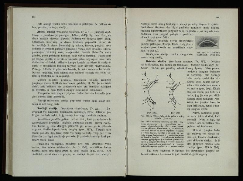 Akių ligų vadovas / Petras Avižonis. – Kaunas: Medicinos fakultetao leidinys, 1940. – VIII, 841, [2] p., 18 iliustr. lap.