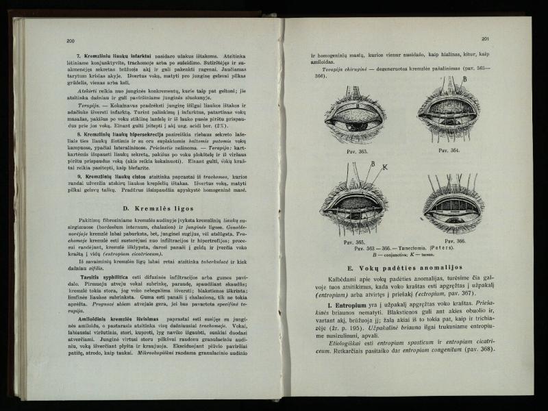 Akių ligų vadovas / Petras Avižonis. – Kaunas: Medicinos fakultetao leidinys, 1940. – VIII, 841, [2] p., 18 iliustr. lap.