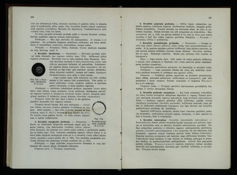Akių ligų vadovas / Petras Avižonis. – Kaunas: Medicinos fakultetao leidinys, 1940. – VIII, 841, [2] p., 18 iliustr. lap.
