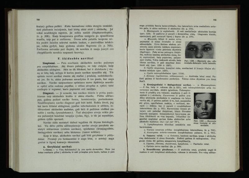 Akių ligų vadovas / Petras Avižonis. – Kaunas: Medicinos fakultetao leidinys, 1940. – VIII, 841, [2] p., 18 iliustr. lap.