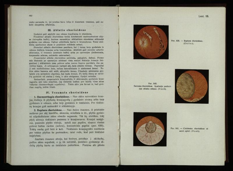 Akių ligų vadovas / Petras Avižonis. – Kaunas: Medicinos fakultetao leidinys, 1940. – VIII, 841, [2] p., 18 iliustr. lap.